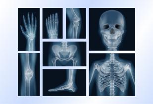 X-Ray & Radiology Films
